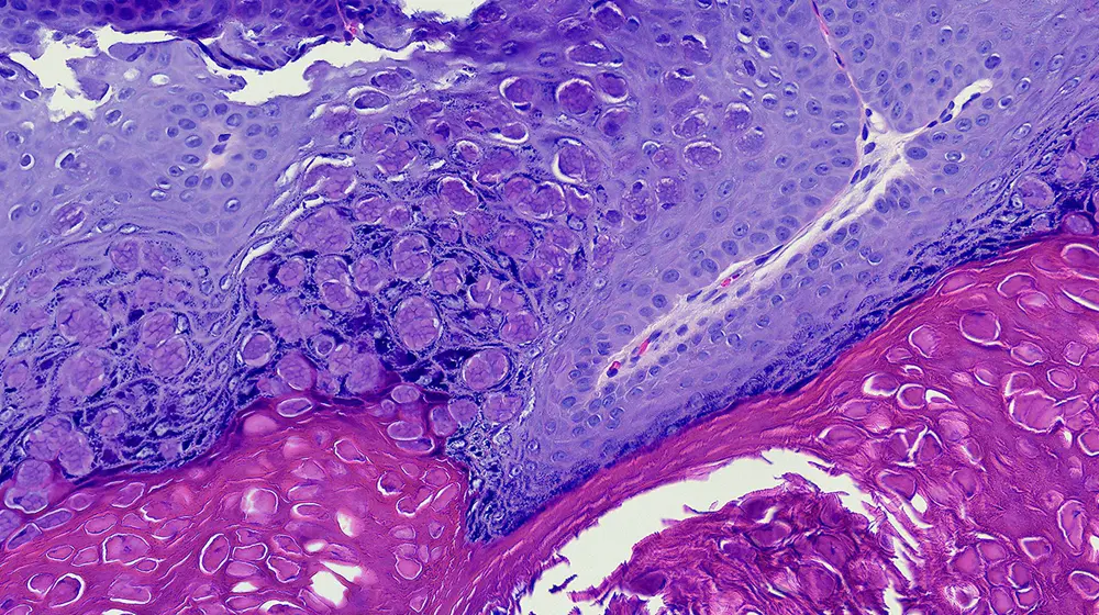 Dermatology Collection Guide