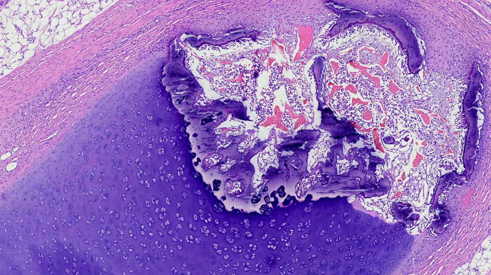 Surgical Pathology Collection Guide