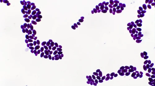 PCR Swab for Candida auris Collection Guide