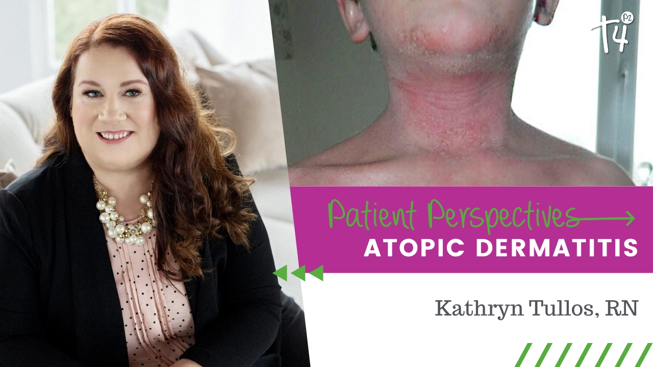 Raising Awareness about Topical Steroid Withdrawal Syndrome and How ...